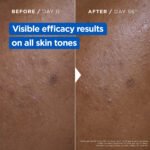 Mixa Niacinamide Bright Intense Dark Spot Correcting Moisturizing Cream - view 3